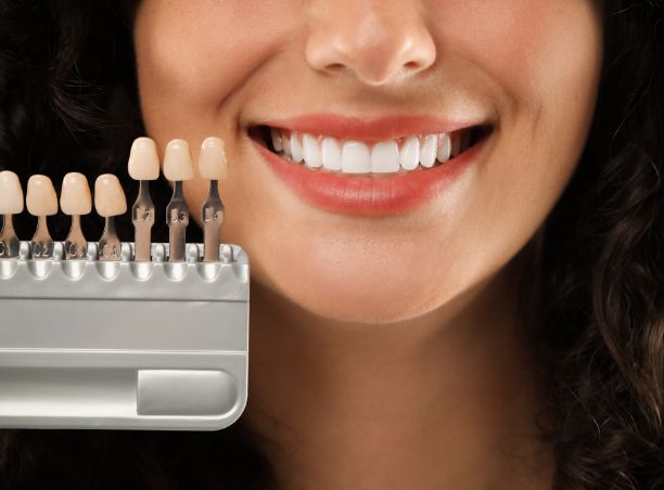 Sbiancamento dentale professionale presso Atelierul de Zâmbete